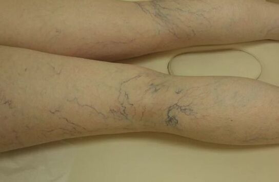 The quiet star on the legs