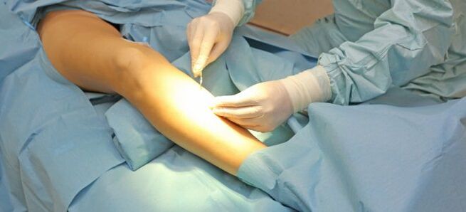 Surgery method