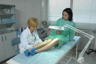 Laser treatment of varicose veins on the legs