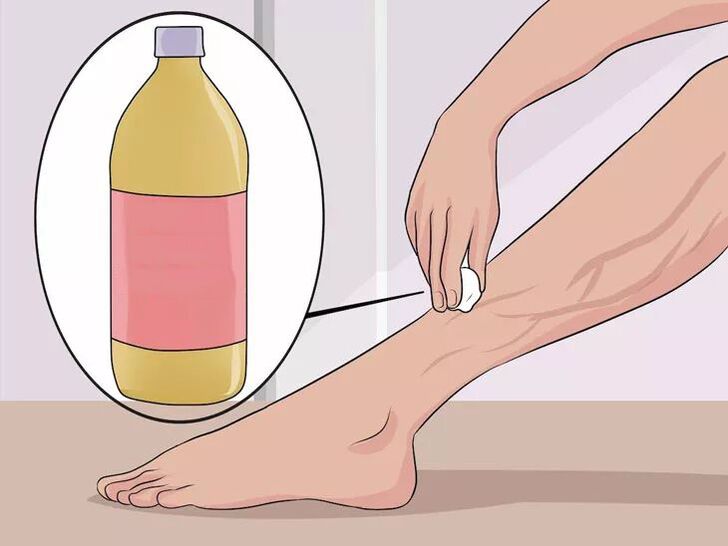 How to rub apple cider vinegar to the affected area